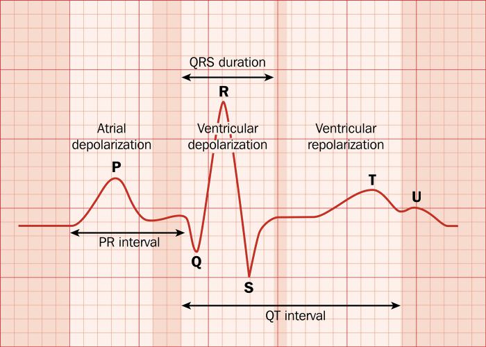 ECG 12-lead BASIC