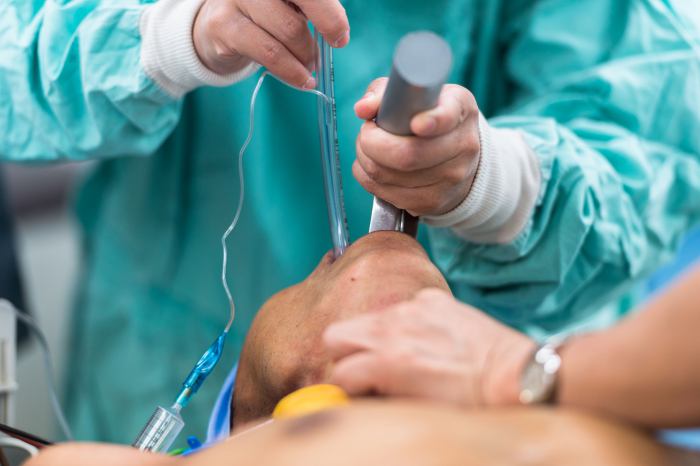 Airway Intubation Airway Intubation