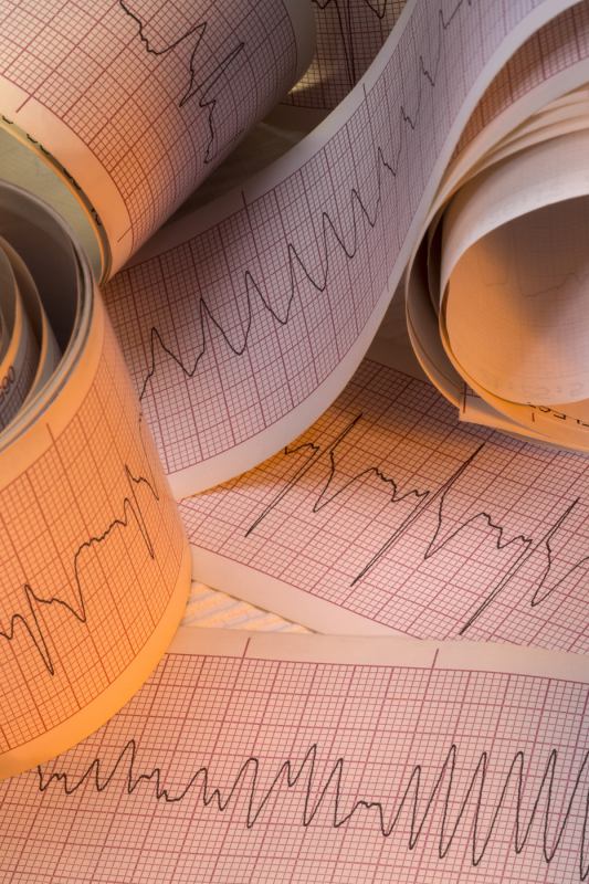 12 Lead ECG